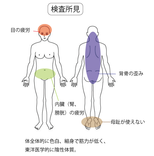 足底腱膜炎の検査所見